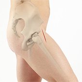 Anterior Hip Replacement